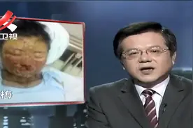 传奇：美女突发高烧，退烧后面目全非，原因竟是一枚退烧针！视频封面