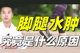 腿脚水肿，腿脚冰凉，这都是体内水湿太多了，告诉你水肿常见因素视频封面