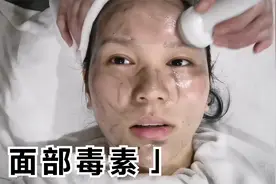去美容院洗脸，她说这黑色东西是我面部的毒素，吓死我了视频封面