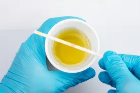 为何尿液发黄发臭？中医提醒：身体在暗示你这3件事，要重视了视频封面