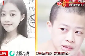 妙龄少女1：少女罹患世界罕见的巨型肿瘤，比成年人的拳头还大！视频封面