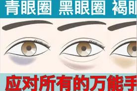 黑眼圈可以用按摩慢慢消除视频封面