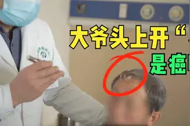 大爷头上开“花”，家人怀疑是癌来求医，医生：这东西有点麻烦视频封面