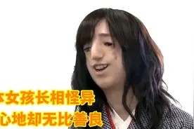 日本女孩患无脸症长相怪异，为下巴做16次整形，真实纪录片视频封面