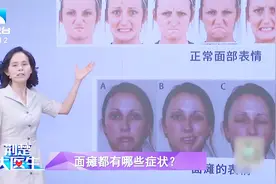 “一笑就嘴歪”怀疑自己得了面瘫，来看面瘫的三大症状你是否符合视频封面