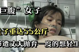 “巨腹”女子，肚子重量达到55公斤，惨遭丈夫抛弃一度的想轻生视频封面