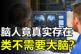 “无脑人”竟真实存在，难道人类可以不需要大脑？视频封面