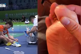 奥运冠军陈雨菲全运会比赛中被运动鞋割伤，李宁最新回应来了视频封面