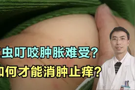 被蚊虫叮咬后肿胀不舒服，医生告诉你，如何用药物快速止痒消肿？视频封面