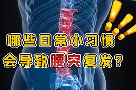 腰椎间盘突出患者，生活中要注意这4点，不然病情易复发视频封面