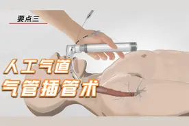 【医识点】--MG动画：气管插管术视频封面