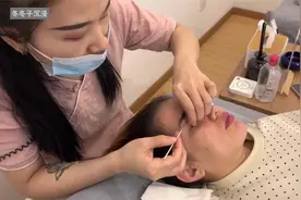 一起体验老手艺银针洗眼、头发丝通泪腺视频封面