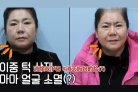 韩国44岁女星带58岁中国婆婆整容，花费数百万韩币，真的值得吗？视频封面