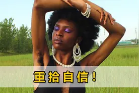 加拿大女子体毛如男人般旺盛，曾想自杀，如今重拾自信大秀胸毛视频封面