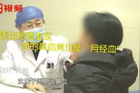 福建一女子“月经血”竟从鼻子流出，医生：做过人流需警惕视频封面