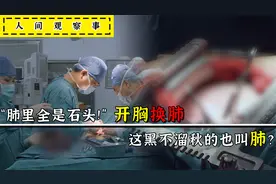 感人！孝顺儿子卖车为父亲换肺，医生：“肺上面都是石头”纪录片视频封面