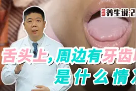 程凯养生说：舌头上，周边有牙齿印是什么情况？视频封面