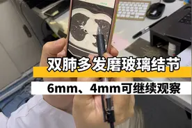 双肺多发磨玻璃结节，有6mm的、4mm的，要处理还是继续观察？视频封面