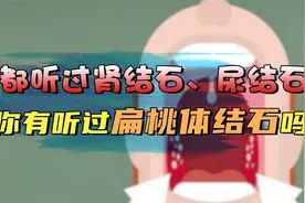 口臭严重，刷牙都去不掉？照镜子看是否有扁桃体结石！很多人不知视频封面