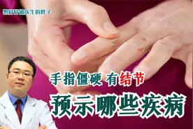 手指肿痛僵硬、有结节，预示着哪些疾病？医生详述常见的6种病因视频封面