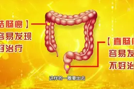 “15厘米的隐患”！一半肠癌发生在这个位置，好发现但不容易治疗视频封面