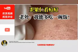 歪果仁看痘痘，老外：我能多吃一碗饭！视频封面