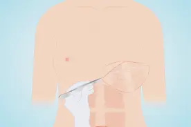 乳房假体可以在人体内存放多久？隆胸时间超过十年，应及时去体检视频封面
