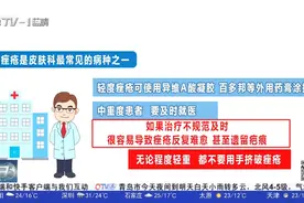 “战痘秘籍”！青岛医学专家教你科学治疗，跟痤疮说再见视频封面