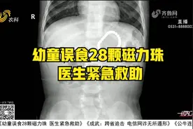 危在旦夕！2岁幼童误食28颗磁力珠，医生紧急手术，5分钟化险情视频封面
