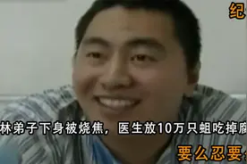 少林弟子下身被烧焦，医生放10万只蛆吃掉腐肉，要么忍要么死