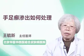 医生详解：手足癣渗出如何处理视频封面