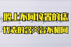 脸上不同位置的痣，代表的含义各不相同，看看你是哪一种？视频封面