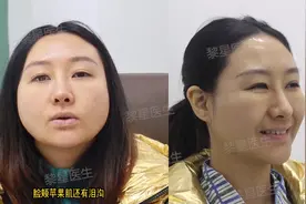 美女注射生长因子，多部位疯长，溶解手术均无效，生活陷入混沌视频封面
