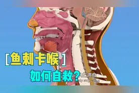 鱼刺卡喉是喝醋、吞饭还是塞大蒜？NO！专家教你三招科学自救妙招视频封面