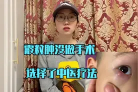 霰粒肿怎样去除，怕留疤不要轻易手术，选择中医治疗方法试试视频封面