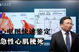 心电图快速鉴定：急性心肌梗死视频封面