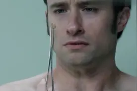 神秘感染：男子检查身体，后背忽然一阵剧痛，拔下一看也太恶心了视频封面