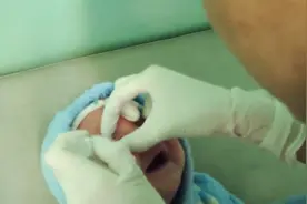 宝宝得了结膜炎，育儿师这样处理，比你想象中的简单视频封面