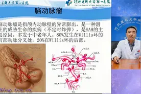 【周四话健康】警惕颅内“炸弹”-脑动脉瘤！视频封面