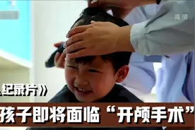 5岁孩子从二楼坠落，导致头部受伤，头骨缺损一大块视频封面