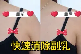 露肉的季节再也不用怕副乳尴尬，这套消除副乳动作，一周就见效视频封面