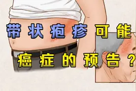 带状疱疹：让人疼痛难忍，还可能是癌症预警！这几类人要特别警惕视频封面