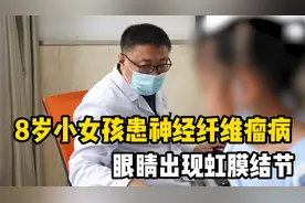 八岁小女孩患神经纤维瘤病，眼睛上出现虹膜结节，女孩：我没生病视频封面