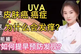 信号癌症 皮肤癌，患者身上为什么会瘙痒？如何预防和发现很重要视频封面