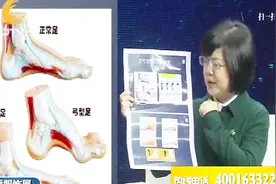 如何辨别扁平足？医生教你“脚印法”，扁平足满脚心视频封面