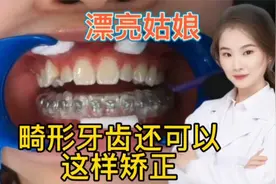 精湛技术 漂亮姑娘畸形的牙齿居然还可以这样矫正 绝赞视频封面