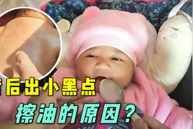 尼泊尔媳妇给女儿擦油，今天发现后背上有小黑点，这是啥情况？视频封面