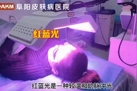 阜阳皮肤科医院-红蓝光治疗痤疮视频封面