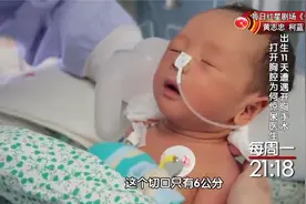 生命：44岁高龄产妇产子，胎儿罕见心率40，进行开胸手术医生傻眼视频封面