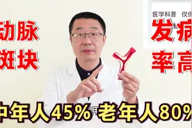 动脉斑块，发病率高！中年人发病率45%，老年人80%，老老年人100%视频封面